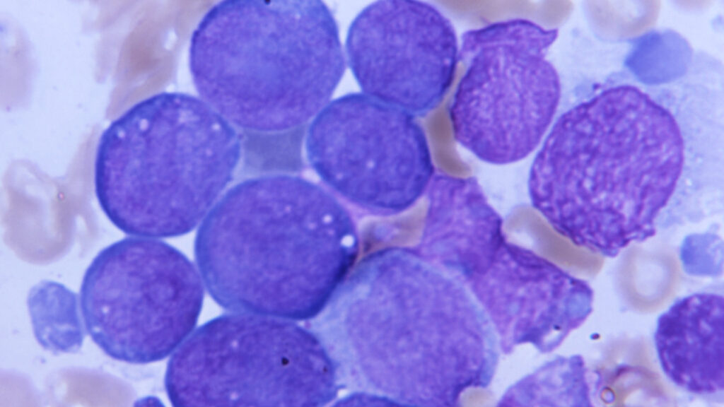 STAT+: At ASH, Terns looks like rival to Novartis with drug for chronic myeloid leukemia