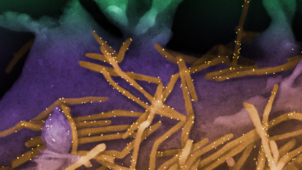 STAT+: FDA scrutiny of infant RSV shots escalates amid turmoil