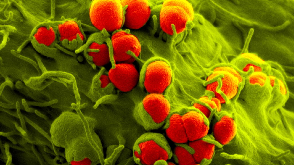 FDA approves first new kind of drug to target gonorrhea in decades