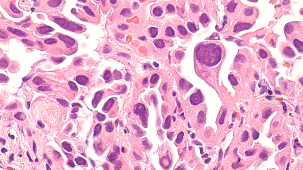 STAT+: EpiBiologics raises $107 million to develop bispecific antibodies against cancer and immune disorders