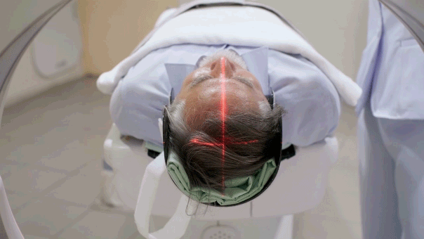 Hidden brain condition may quadruple dementia risk in older adults, study suggests